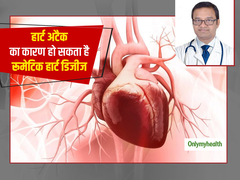 Rheumatic Heart Disease Symptoms In Hindi